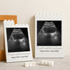 Custom Photo I Cannot Wait To Meet You Baby Scan Building Brick Blocks Happy Father's Day TH10 898853