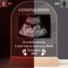 Custom Photo Baby’s Ultrasound LED Night Light TH10 171363