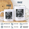 Custom Photo Happy Father's Day Baby Scan Mug - Gift For Father's Day TH10 169933