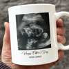 Custom Photo Happy Father's Day Baby Scan Mug - Gift For Father's Day TH10 169933