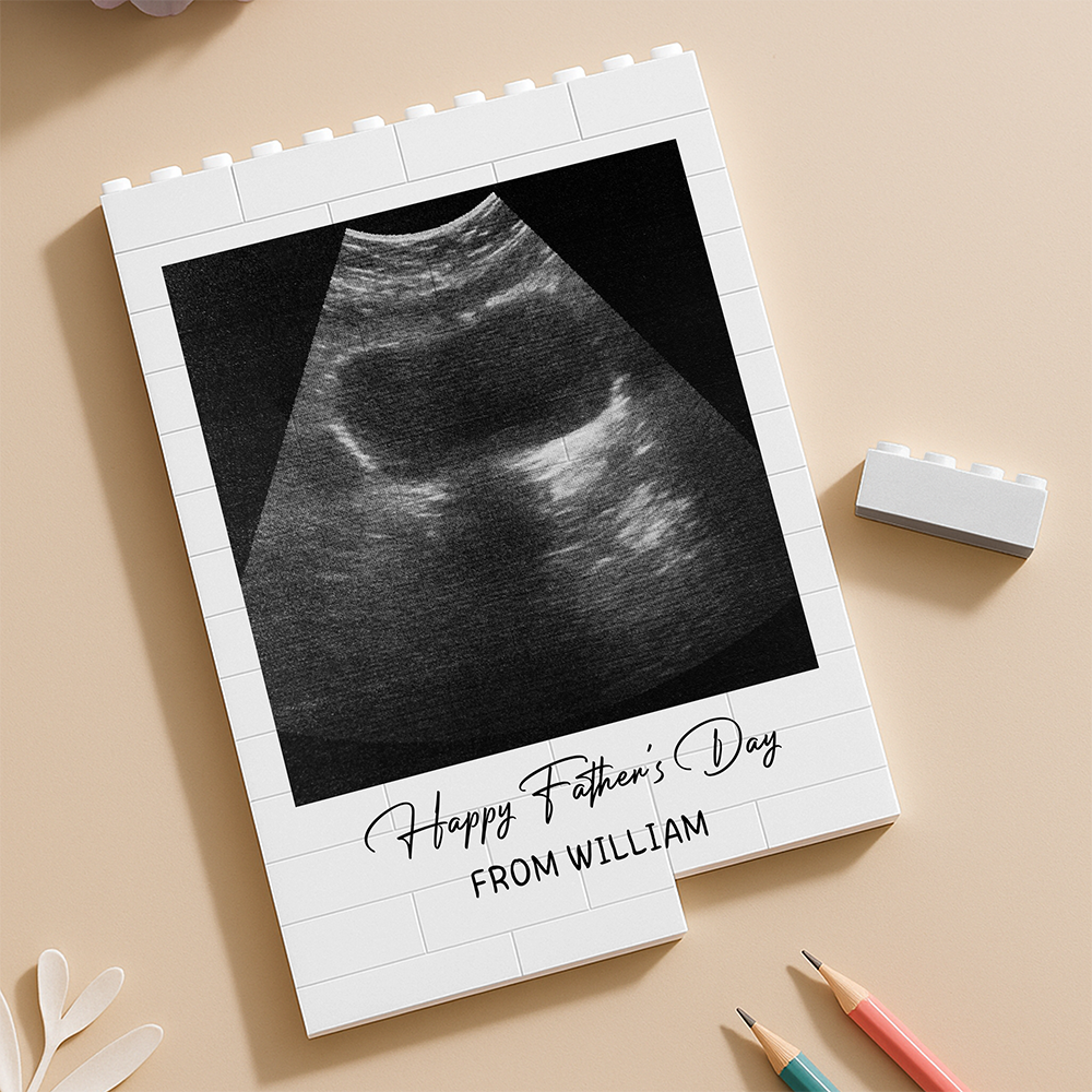 Custom Photo Happy Father's Day Baby Scan Building Brick Blocks TH10 898857