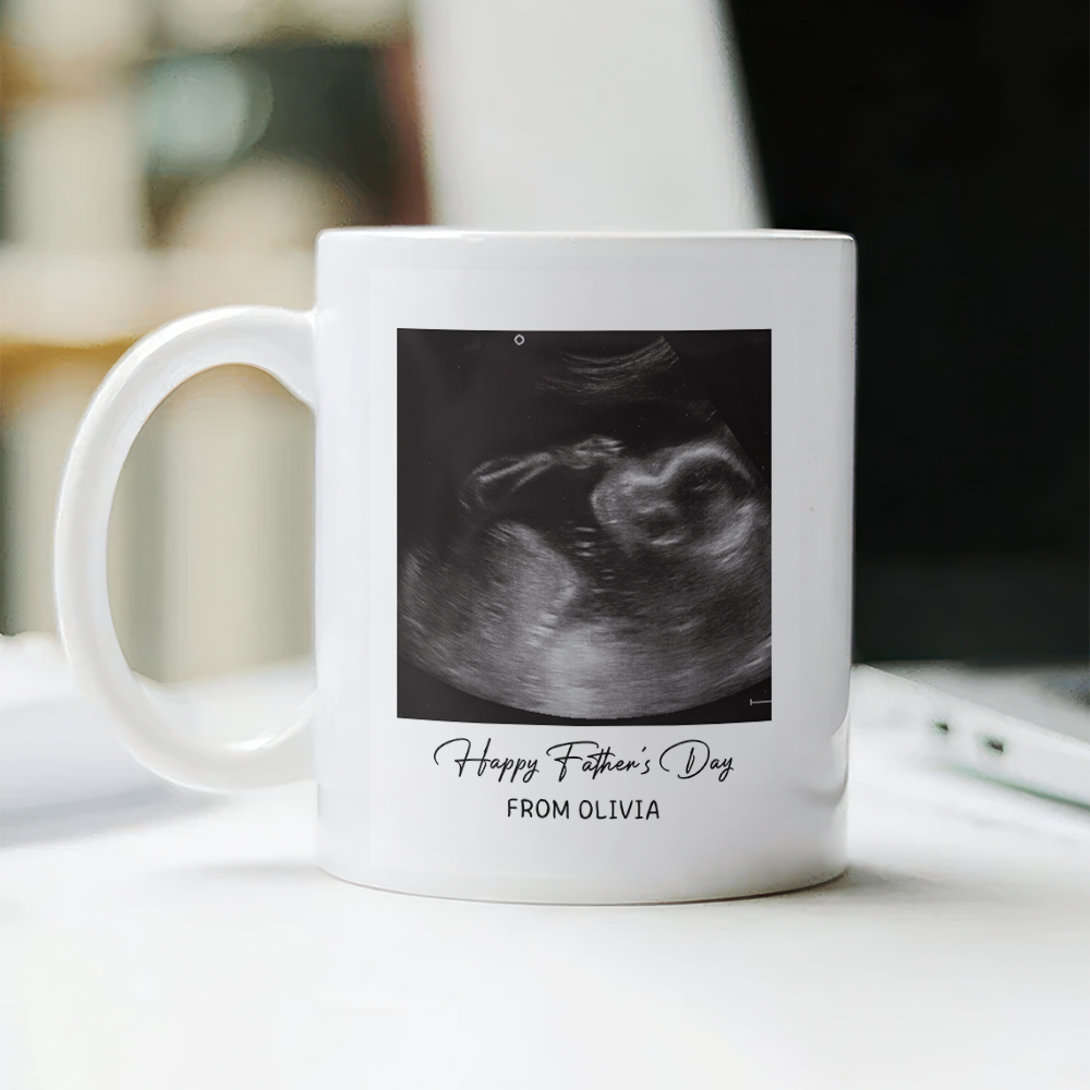 Custom Photo Happy Father's Day Baby Scan Mug - Gift For Father's Day TH10 169933